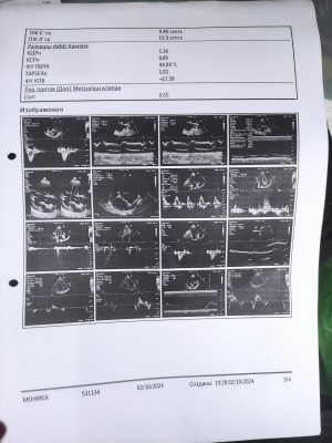 IMG_20241003_083229.jpg (240.79 КБ) 8274 просмотра IMG_20241003_083229.jpg